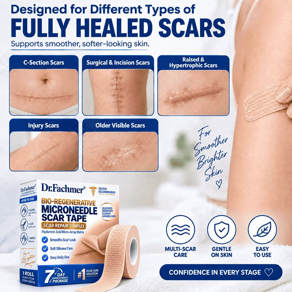 🔥 𝐎𝐟𝐟𝐢𝐜𝐢𝐚𝐥 𝐒𝐭𝐨𝐫𝐞丨Dr.Fachmer® 🩹 Bio-Regenerative Microneedle Scar Tape——Remove all kinds of skin scars