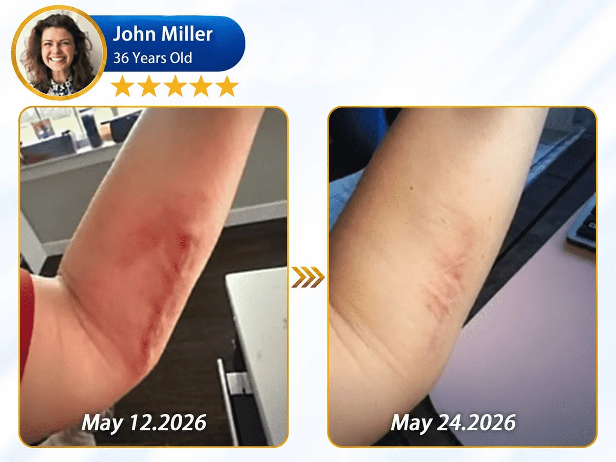 🔥 𝐎𝐟𝐟𝐢𝐜𝐢𝐚𝐥 𝐒𝐭𝐨𝐫𝐞丨Dr.Fachmer® 🩹 Bio-Regenerative Microneedle Scar Tape——Remove all kinds of skin scars
