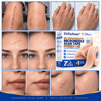 🔥 𝐎𝐟𝐟𝐢𝐜𝐢𝐚𝐥 𝐒𝐭𝐨𝐫𝐞丨Dr.Fachmer® 🩹 Bio-Regenerative Microneedle Scar Tape——Remove all kinds of skin scars