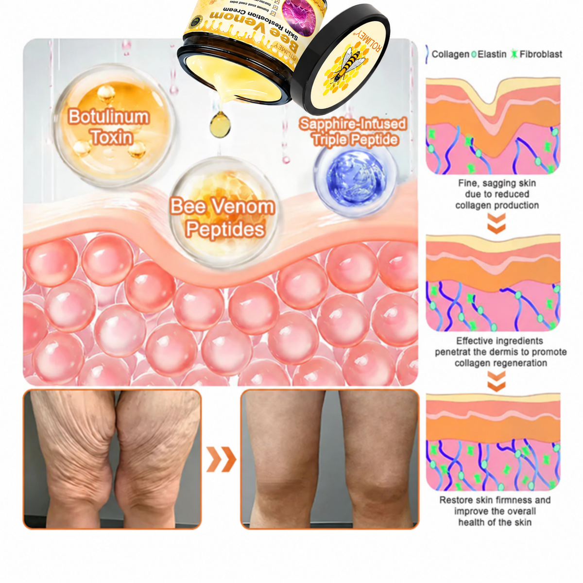 🔥Official Brand Shop丨Rolimey® Bee venom Pro Comprehensive Cream—Tightening for Skin Types